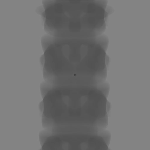Simulated fluoroscopy X-ray output